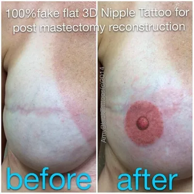 Meet The Woman Tattooing Nipples On Breast Cancer Patients Post-Mastectomy  | HuffPost UK Life