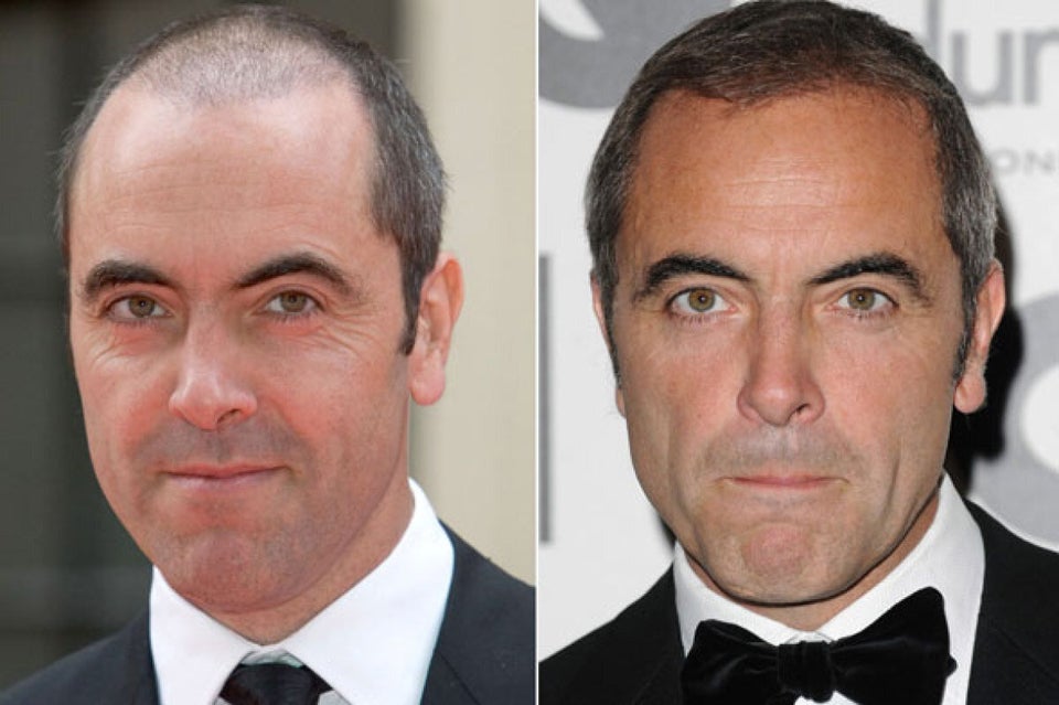 James Nesbitt