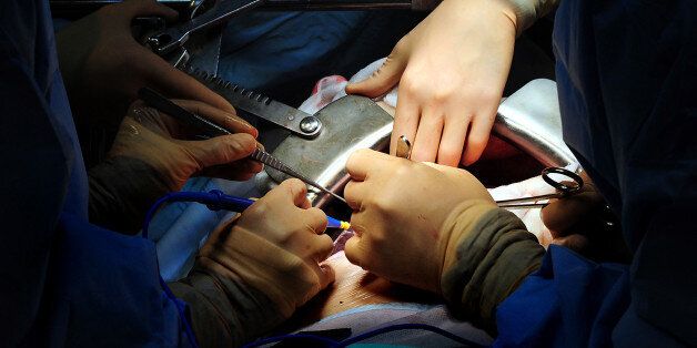 File photo dated 07/04/11 of an operation taking place, as operating theatres have been compared to "an old boys' club" by one of Britain's leading female surgeons, Jyoti Shah.