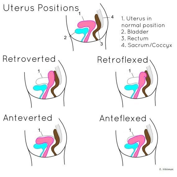 No period pain 2025 in right side