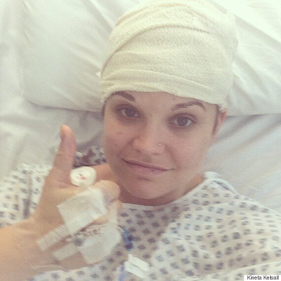 Woman Who Stayed Awake During Brain Surgery Explains What It Actually ...