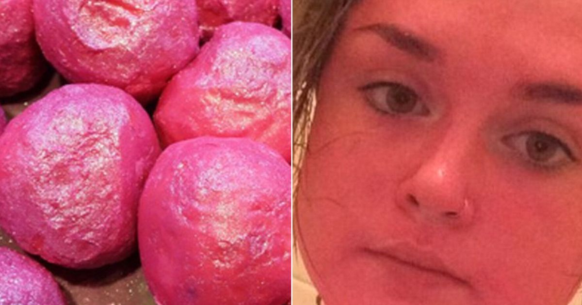 Womans Skin Turns Bright Pink After She Rubs Lush Product All Over Her 