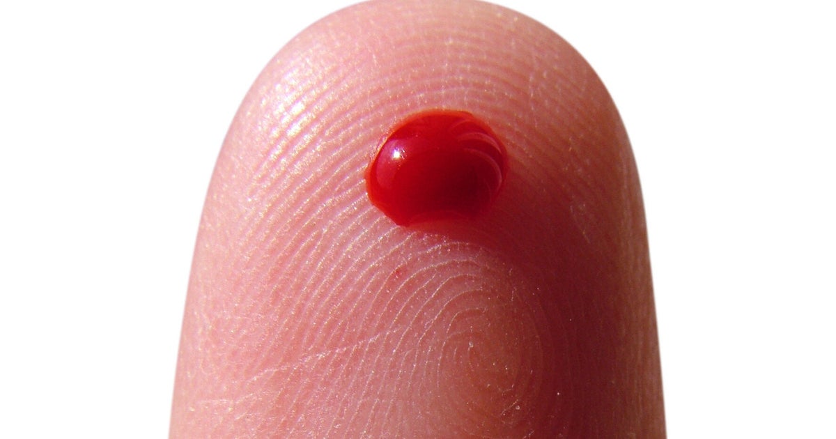 Meet The Blood Test VirScan That Can Reveal Every Virus You've Ever