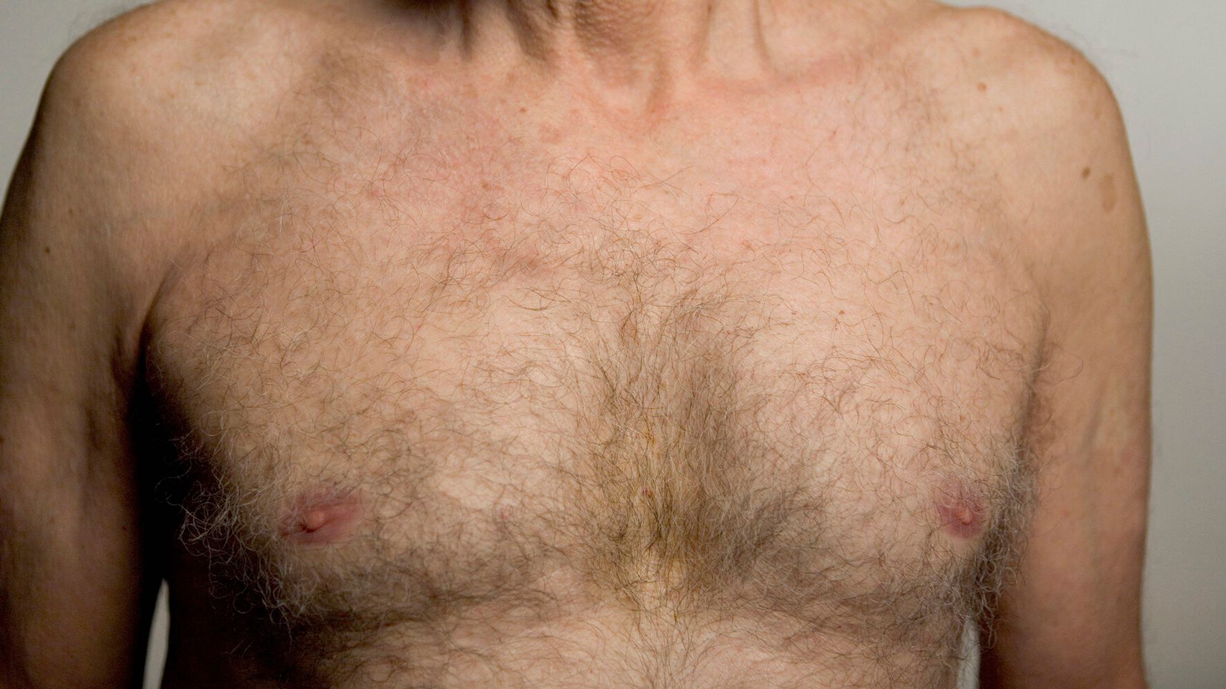 6-things-men-affected-by-breast-cancer-want-you-to-know-huffpost-uk-life