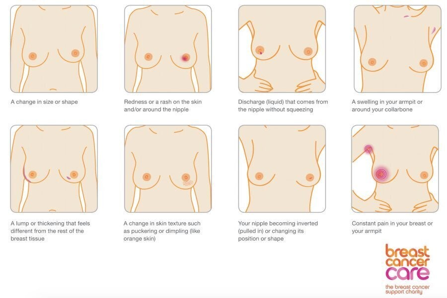 Breast Cancer Symptoms Are 'More Than A Lump', Here Are The Other Signs To  Look For