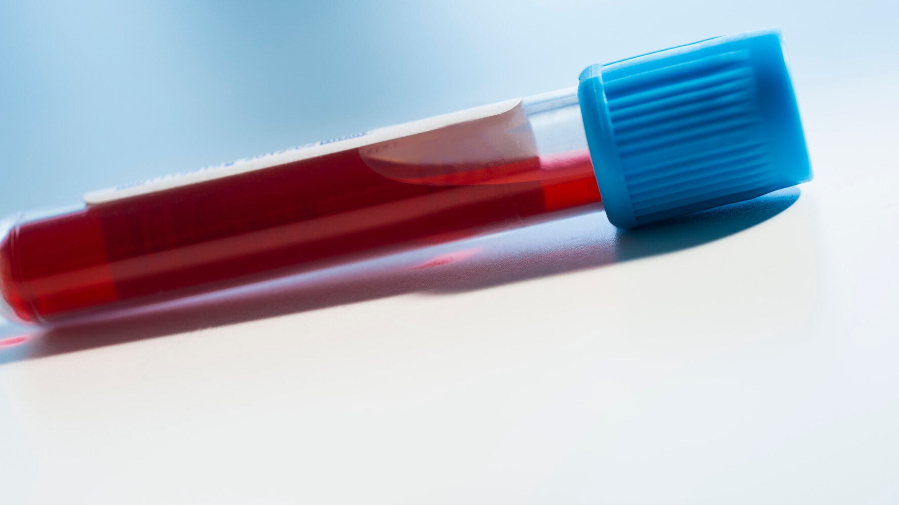 Down's Syndrome Screening In Pregnancy DNA Blood Test For Pregnant