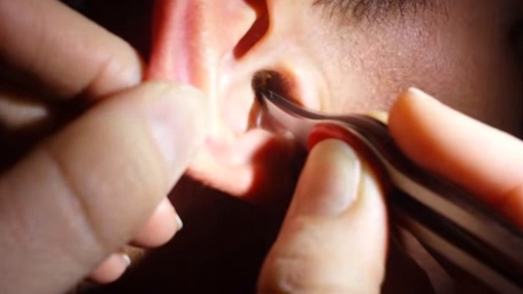 how-to-get-rid-of-earwax-blockage-youtube