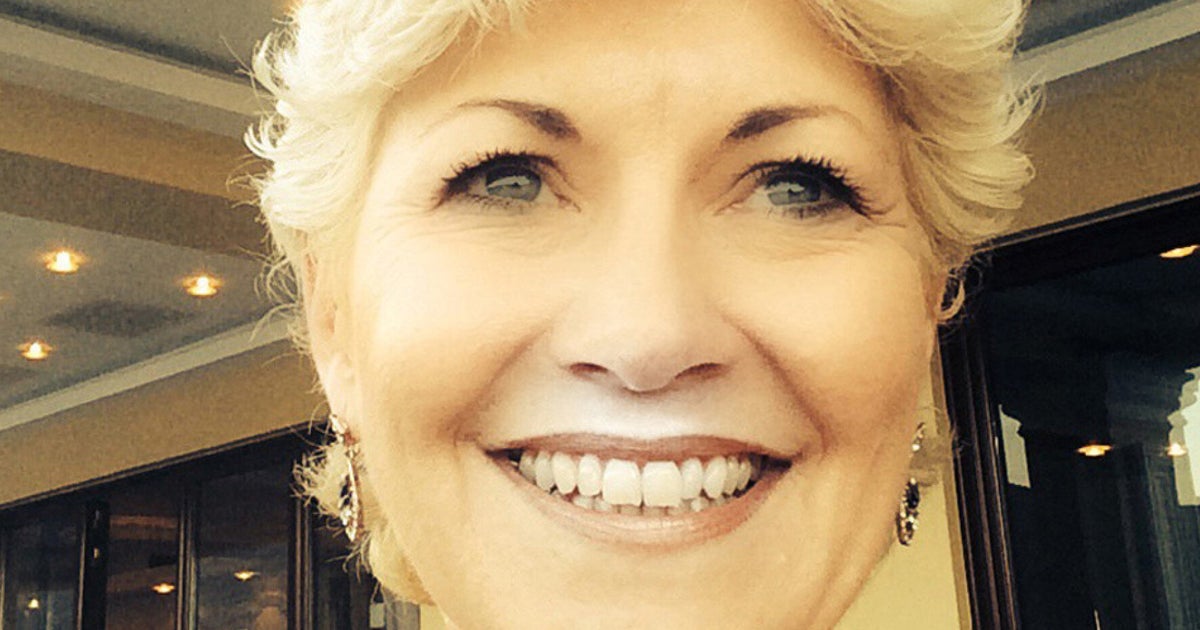 Woman With Dental Drill Bit Lodged In Her Mouth For Two Years Opens Up ...