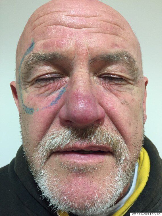 Man Wakes Up With 'Ray-Ban' Sunglasses Tattooed On His Face After Friend's  Stag Do | HuffPost UK Life