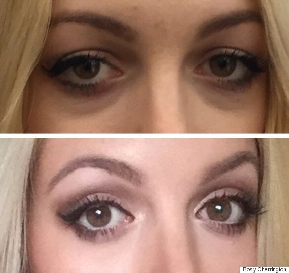 how to get rid of under eye bags with makeup