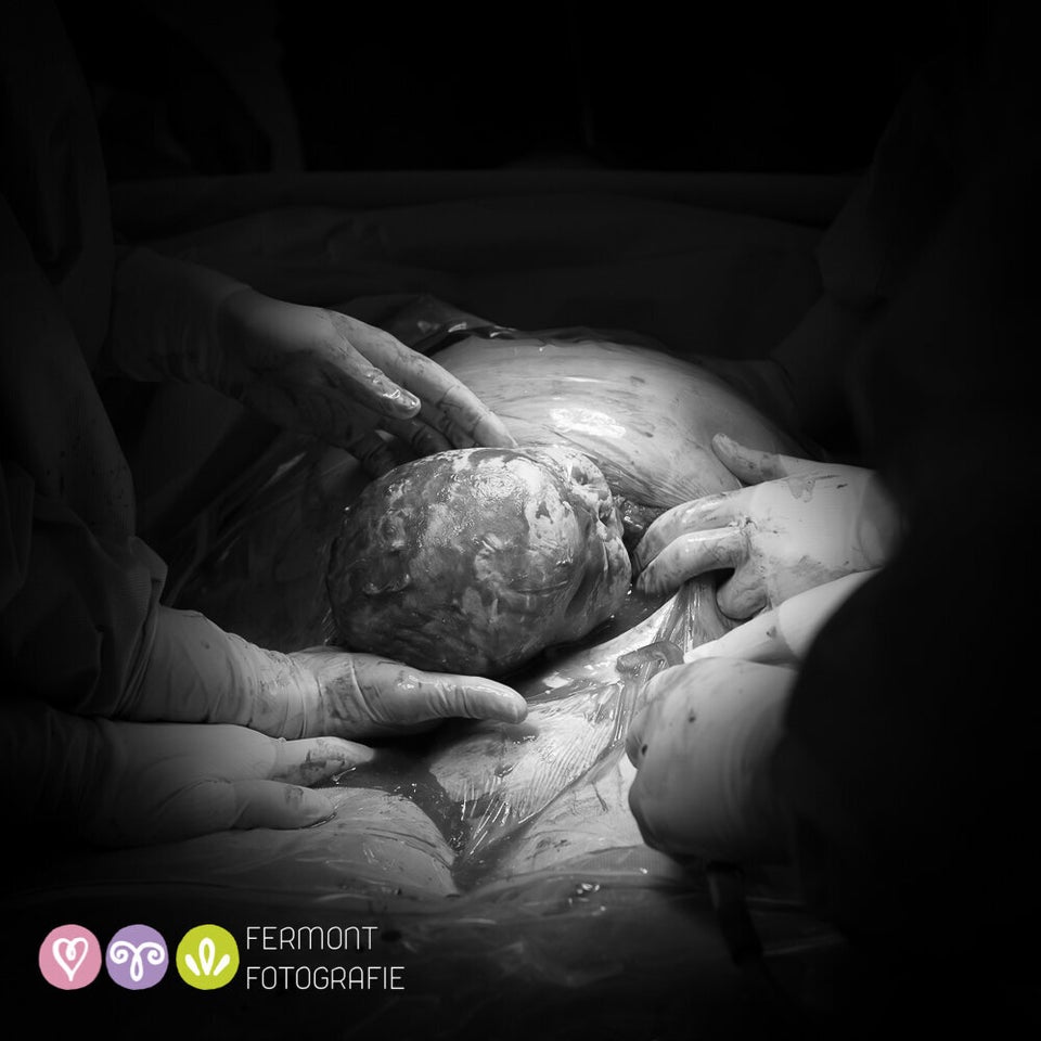 Dutch photographer Mary Fermont takes stunning photos moments after babies  are born