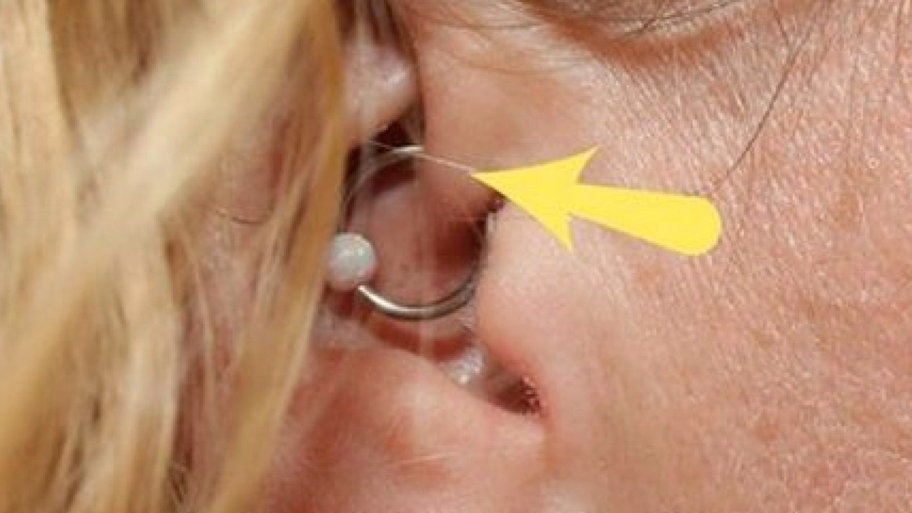 Can Daith Piercing Stop Migraines Here S What You Need To Know About The Ear Piercing Trend Huffpost Uk Life