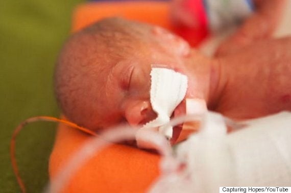 Beautiful Time Lapse Video Shows Premature Baby Transform In First Three Months Of His Life Huffpost Uk Parents