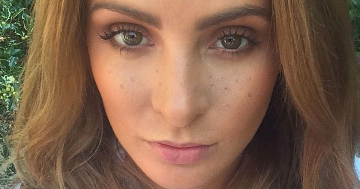 What Are Freckles Everything You Need To Know Including How To Fake 
