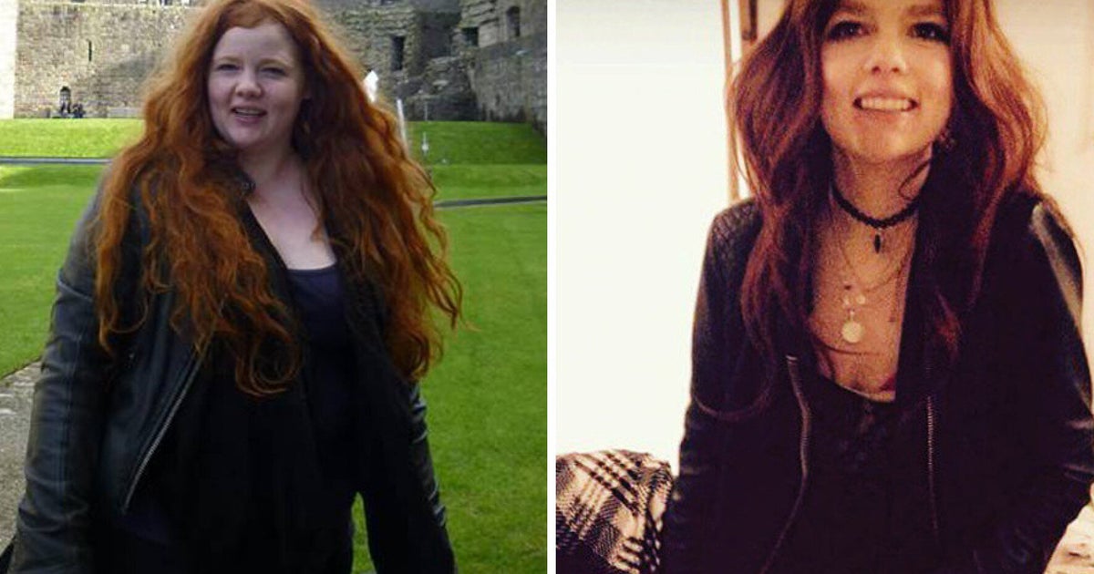 Woman Discovers Her Dramatic Weight Loss Is Actually Due To Cancer