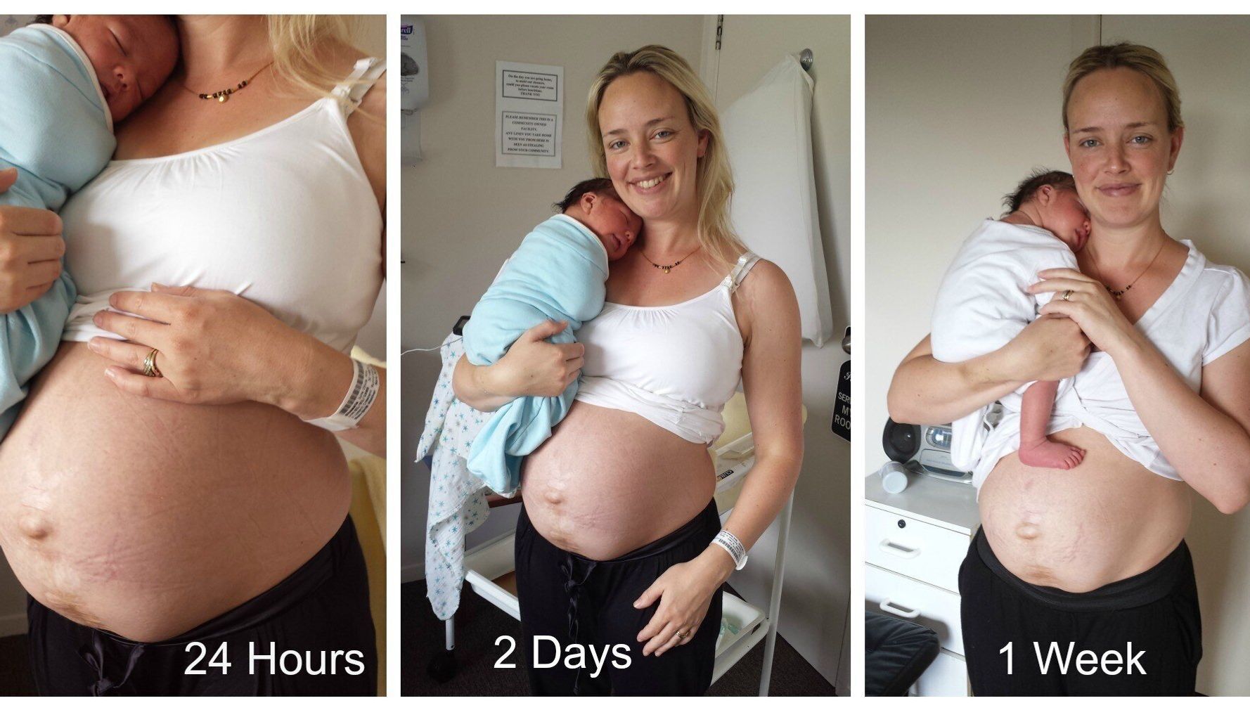 I'm fed up of seeing photos of mums and their 'snap back' post-baby bodies  - it's isolating to new mums and unhealthy