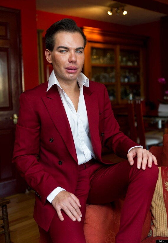 Real Life Ken Doll Rodrigo Alves Is The First Person In The UK To