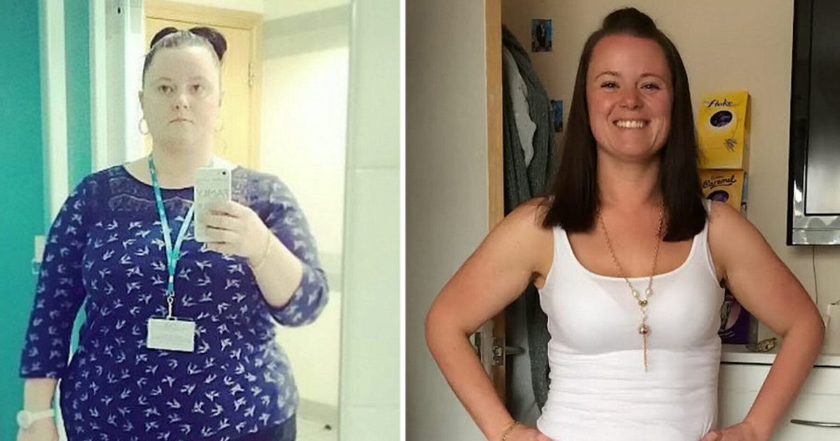 Seven Stone Weight Loss Credited With Drinking 9 Cups Of