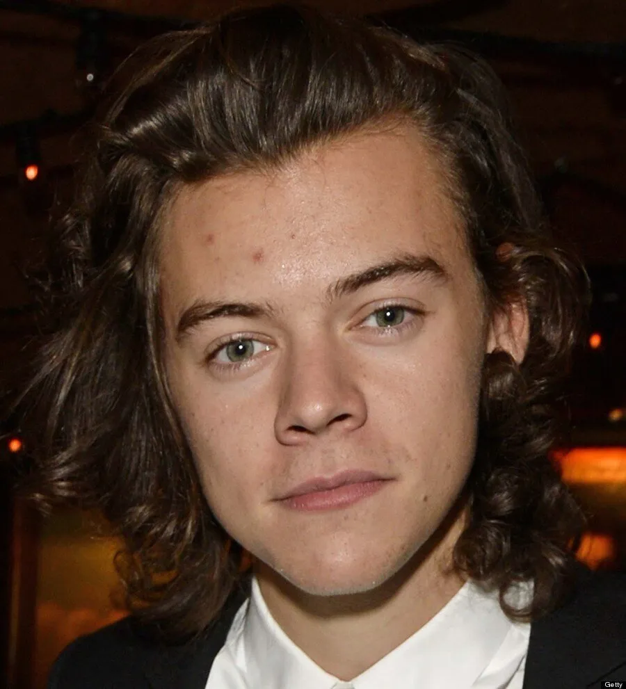 Harry Styles Then & Now: Photos From Young One Direction Days To