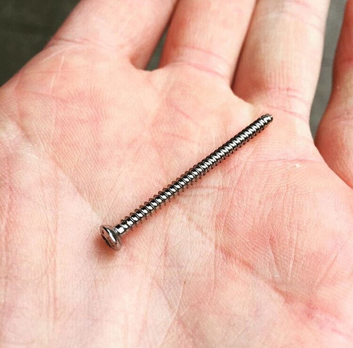 Bone screw