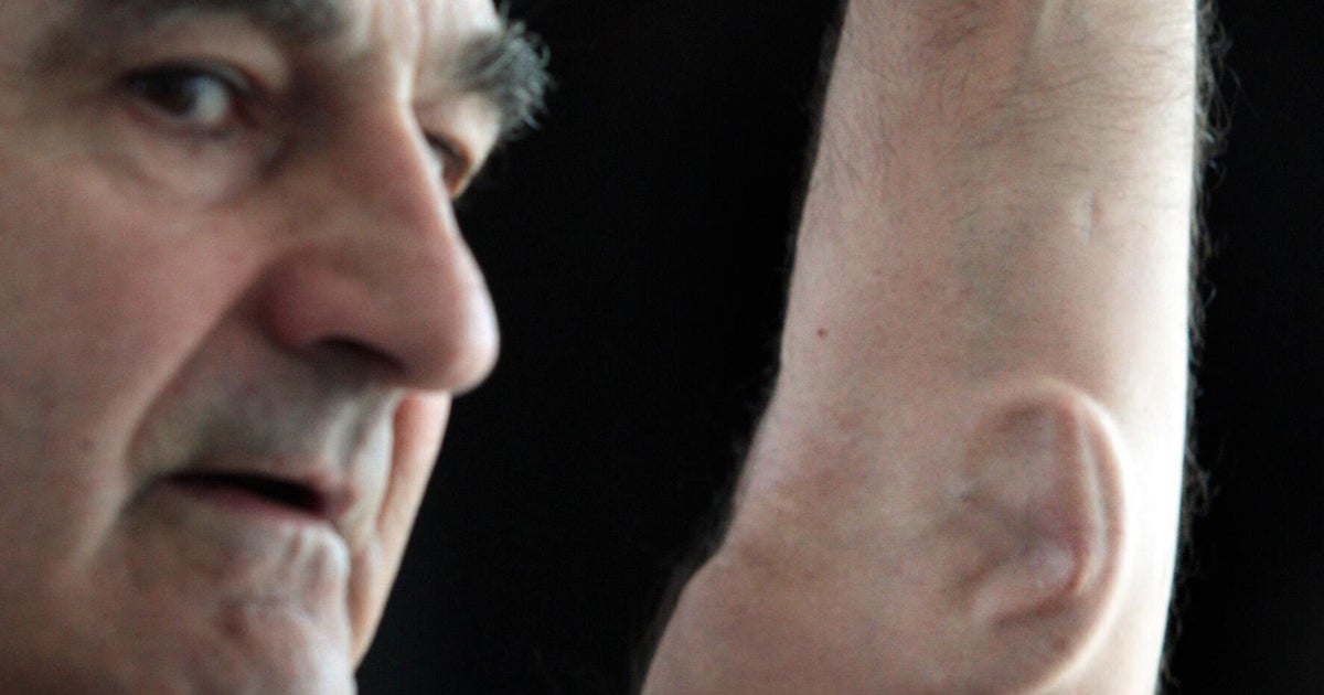 Australian 'Artist' Stelarc Grows Artificial Ear On His Arm To Help