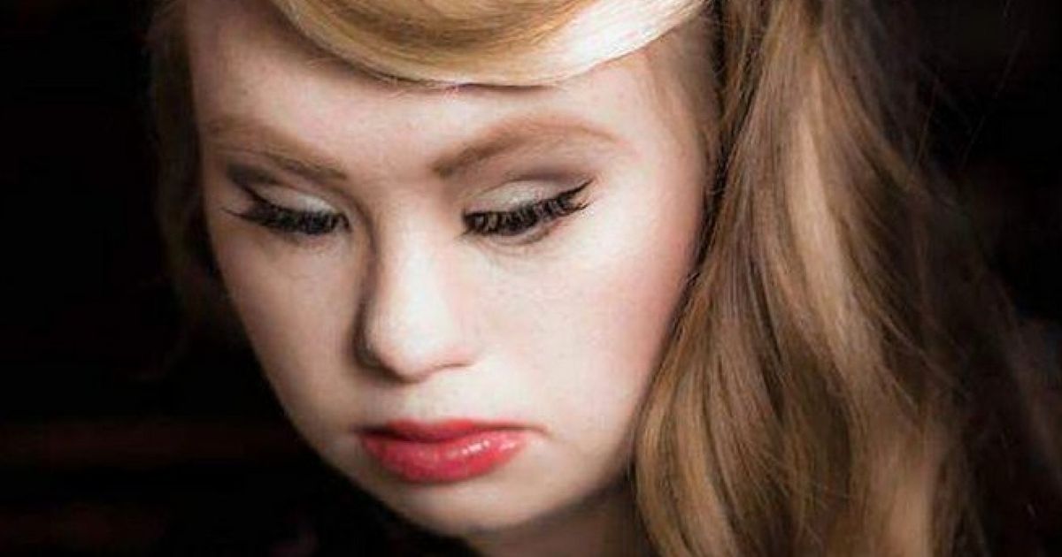 Madeline Stuart Model With Downs Syndrome Will Walk At New York 