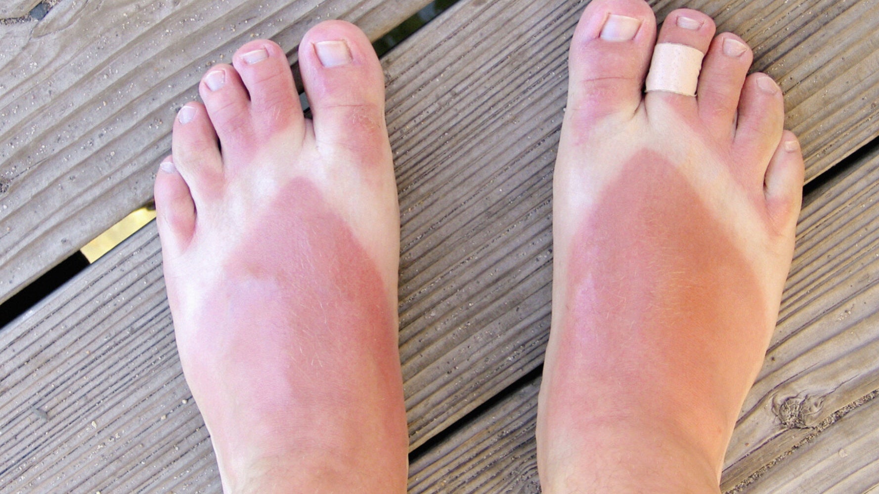 Can You Really Burn When It's Cloudy? HuffPost UK Life