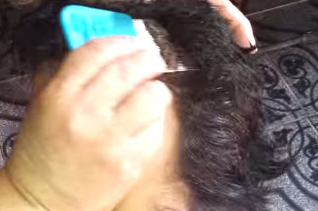 Is this the worst case of head lice ever? Video shows girl infested with  HUNDREDS of nits - World News - Mirror Online