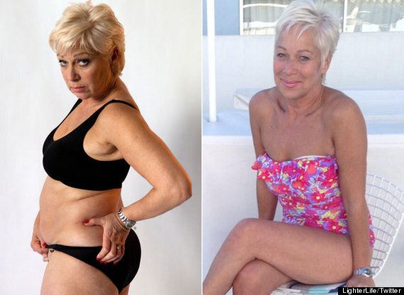 LighterLife slimming advert featuring Denise Welch banned 