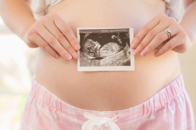 Pregnant woman holding scan