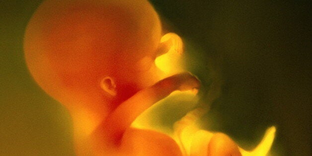 The 18-week-old foetus had 'little chance of survival' (file picture)