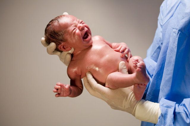 Doctor holding crying newborn baby (0-3 months)