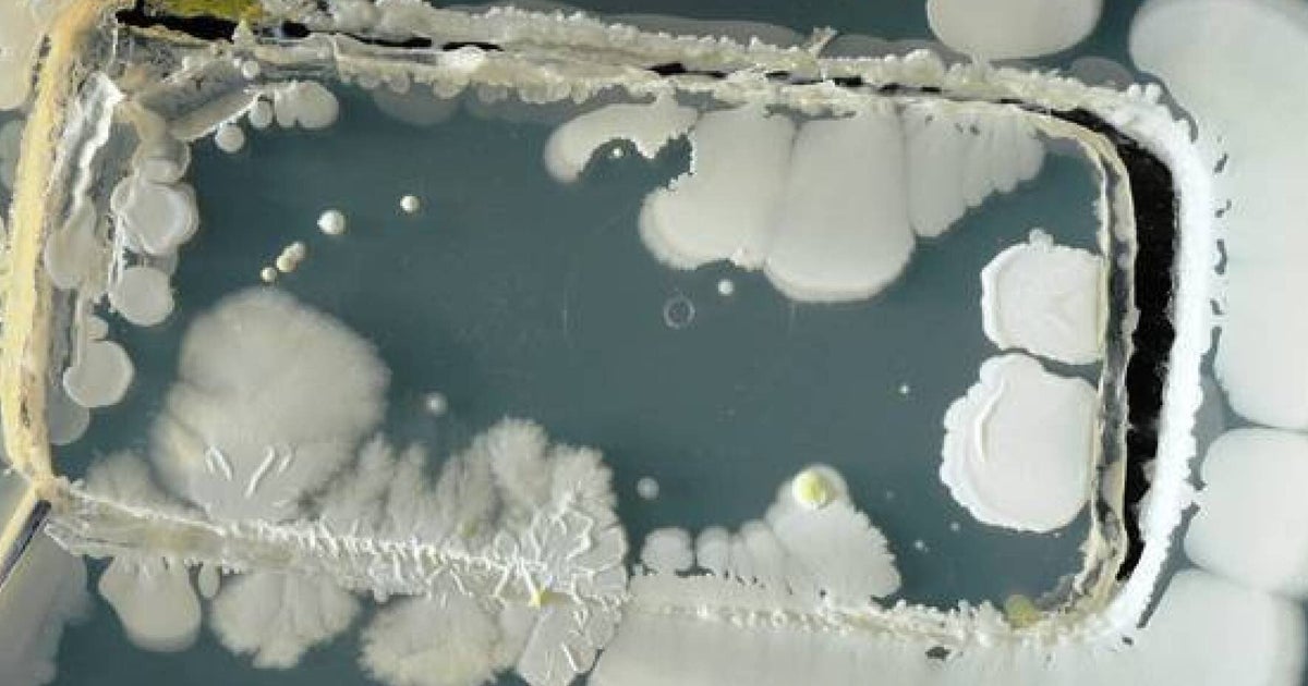 How Fithy Is Your Phone? Shocking Bacteria Study Proves You Have No ...