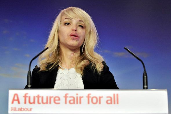 Former model and acid attack victim Katie Piper at a press conference for Labour's plans for safer communities at the party HQ in Victoria Street, London.