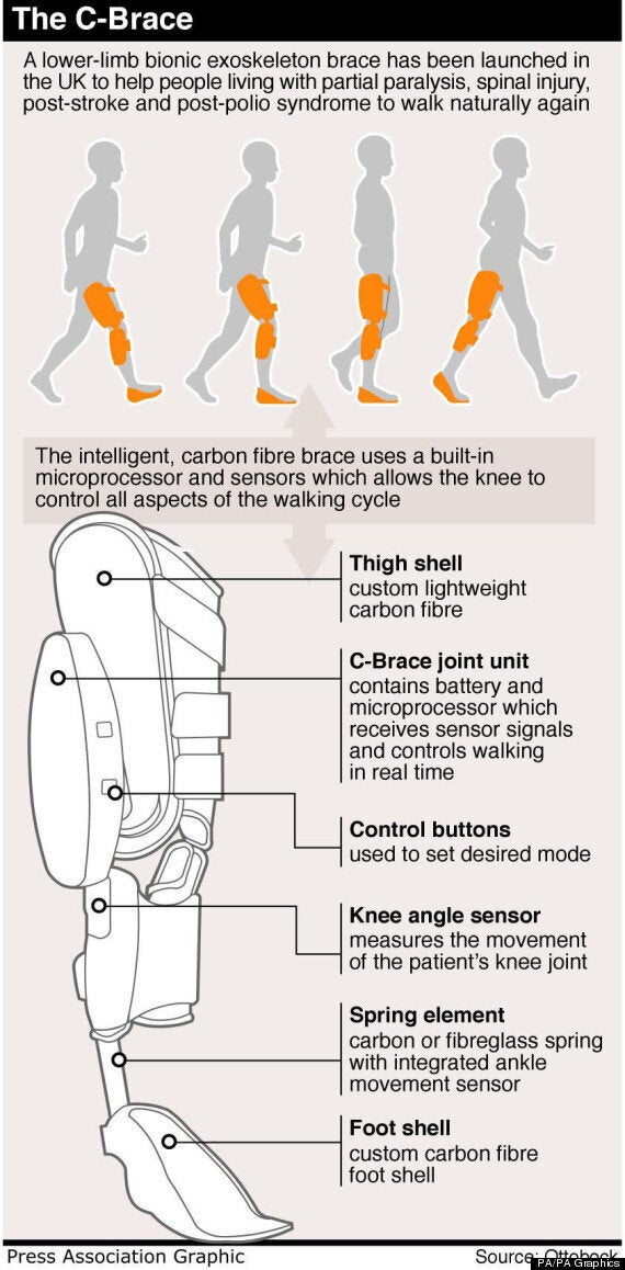 C-Brace, C-Brace