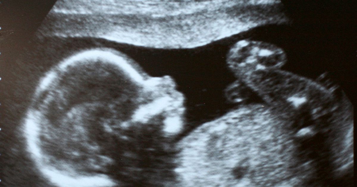 'Feminist' 'Aborts Baby Because It's A Boy' And Is Surprised By Backlash