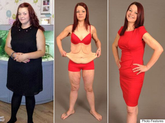 Bride Left With Excess Skin After Losing 9 Stone For Wedding Says Slimming Destroyed Her Life
