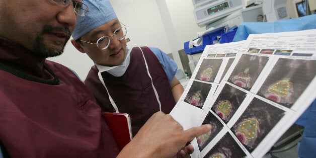 SAN FRANCISCO - AUGUST 17: Dr. Katsuto Shinohara (L) and Dr. I-Chow Hsu review images of a prostate with cancer before performing a bracytherapy operation on a man with prostate cancer at the UCSF Comprehensive Cancer Center August 17, 2005 in San Francisco, California. The UCSF Comprehensive Cancer Center continues to use the latest research and technology to battle cancer and was recently rated 16th best cancer center in the nation by US News and World Report. (Photo by Justin Sullivan/Getty