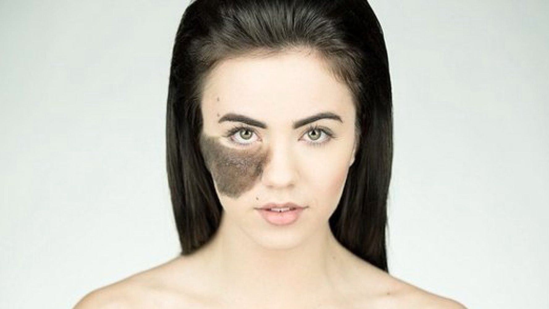 Woman Who Was Bullied For Birthmark Has Some Inspirational Advice