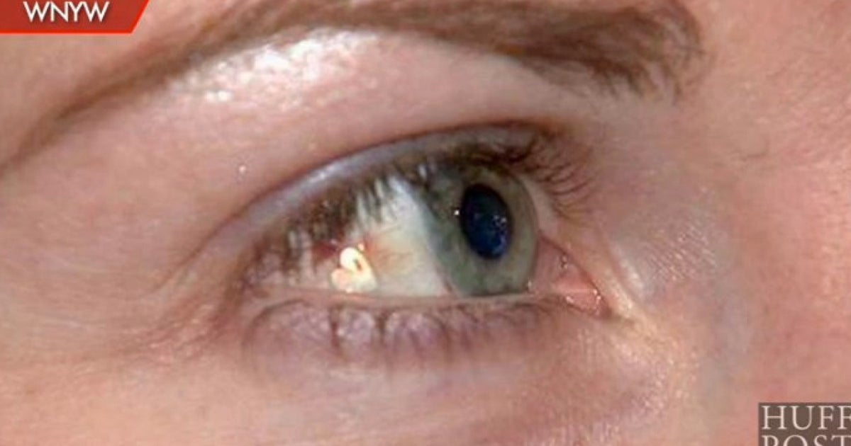 Woman Gets 3,000 Eye Jewellery Procedure But Will The BlingTastic