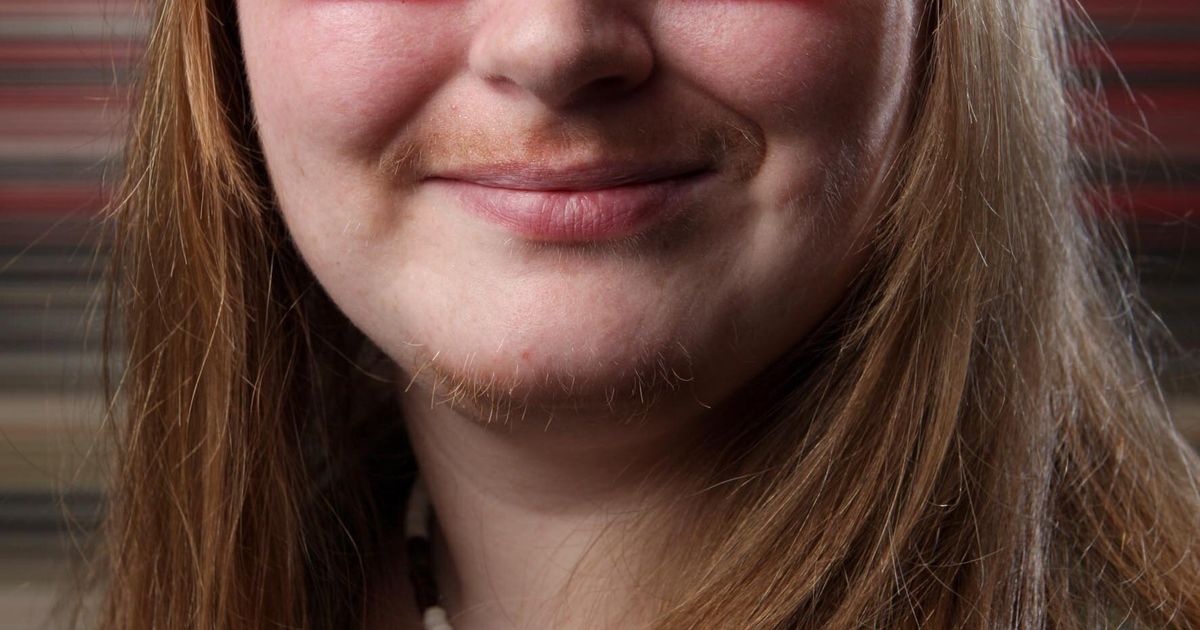 Sarah O Neill Woman Growing Moustache For Movember May