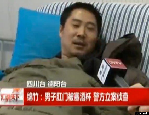 Shot Glass Inserted Into Anus Of Chinese Man Who Was Asked