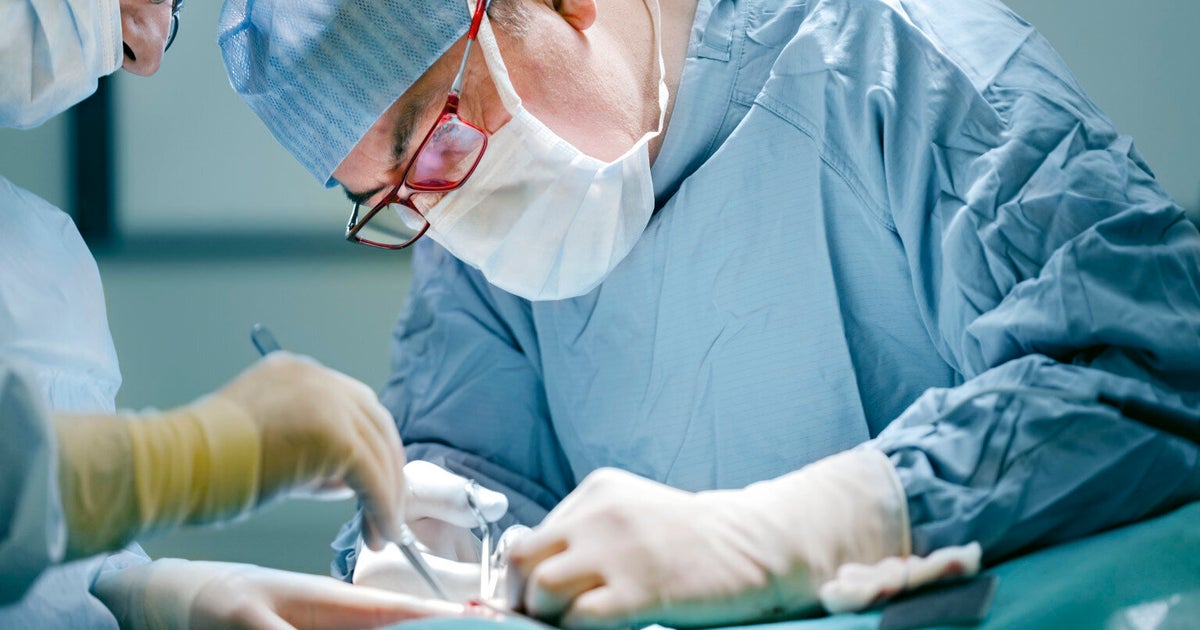 Human Head Transplants Are No Longer Science Fiction Huffpost Uk Life