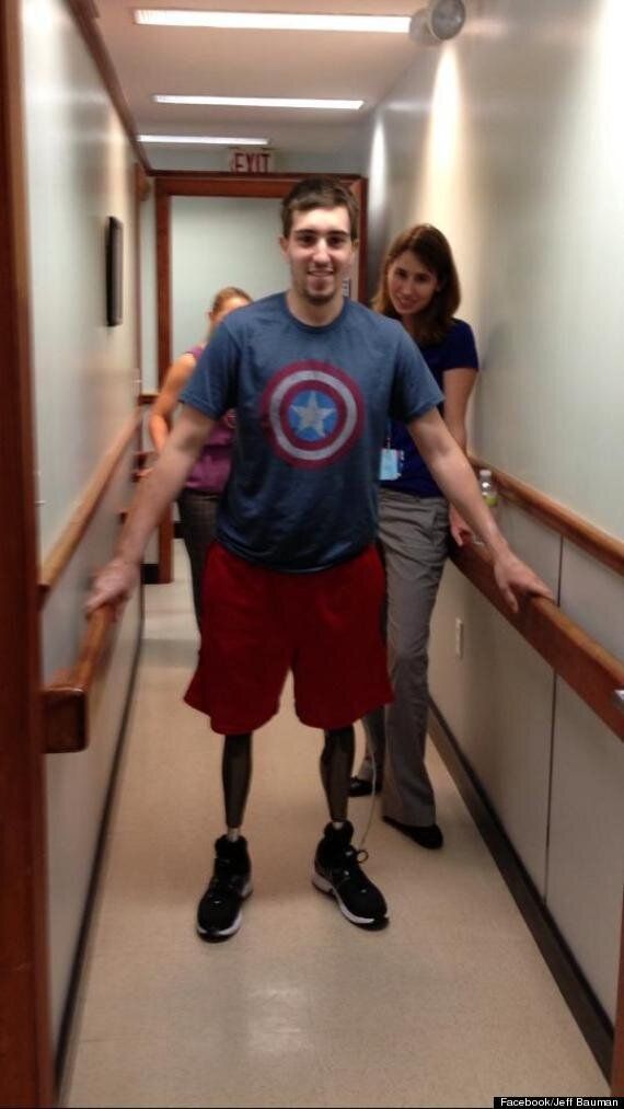 Jeff Bauman Who Lost Both Legs In Boston Marathon Bombing, Walks On