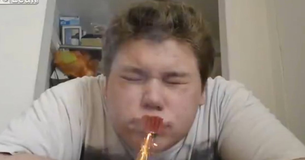 Man Tapes Firecrackers To Lip, Predictably Gets Hurt HuffPost UK Tech
