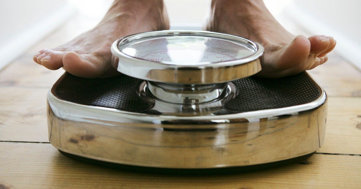 The Future Of Weight Loss? Obalon Gastric Balloon Can Be Swallowed