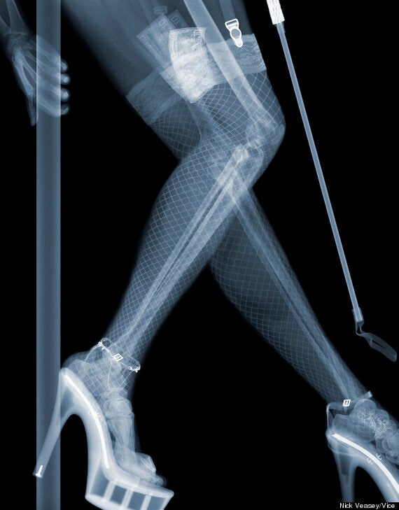 X Ray Voyeurism Nick Veasey S Images Explore What Lies Beneath Pictures Huffpost Uk