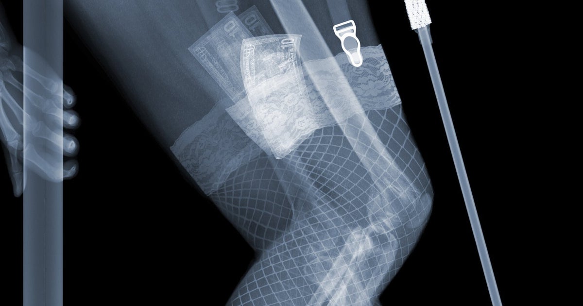 X-Ray Voyeurism Nick Veaseys Images Explore What Lies Bene picture