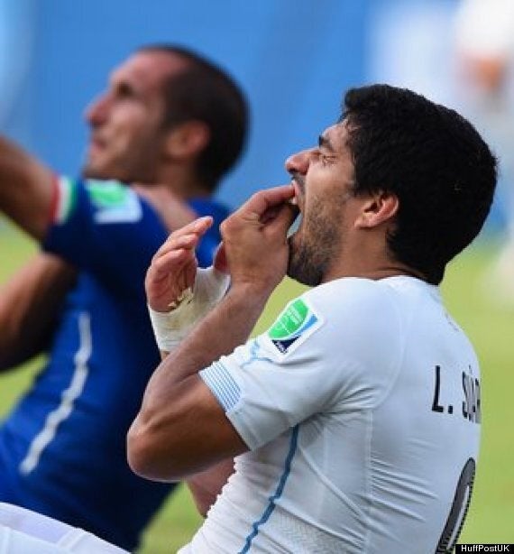 luis suarez bite ear