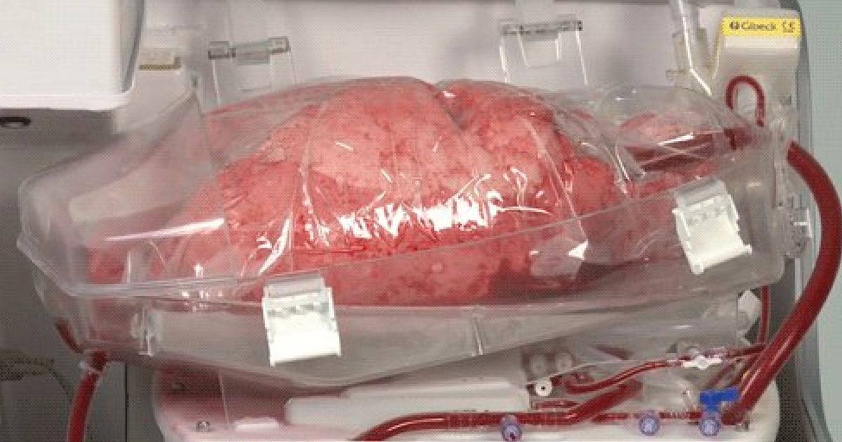 How A Human Donor Lung Is Kept Alive Before A Transplant Huffpost Uk